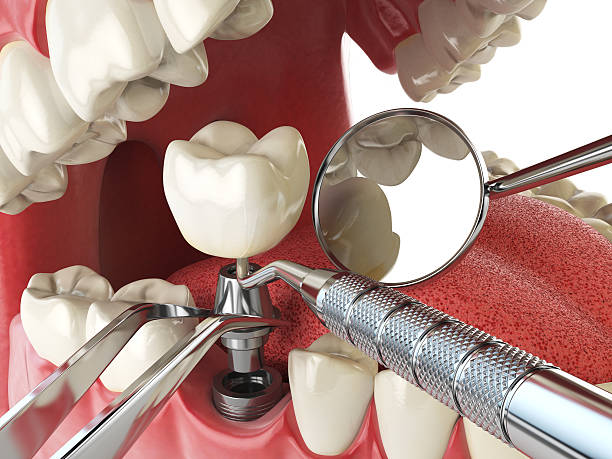 Best Dentist for Tooth Abscess  in Weeping Water, NE